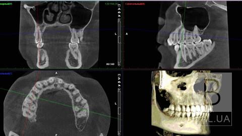 Види діагностики в сучасній стоматології