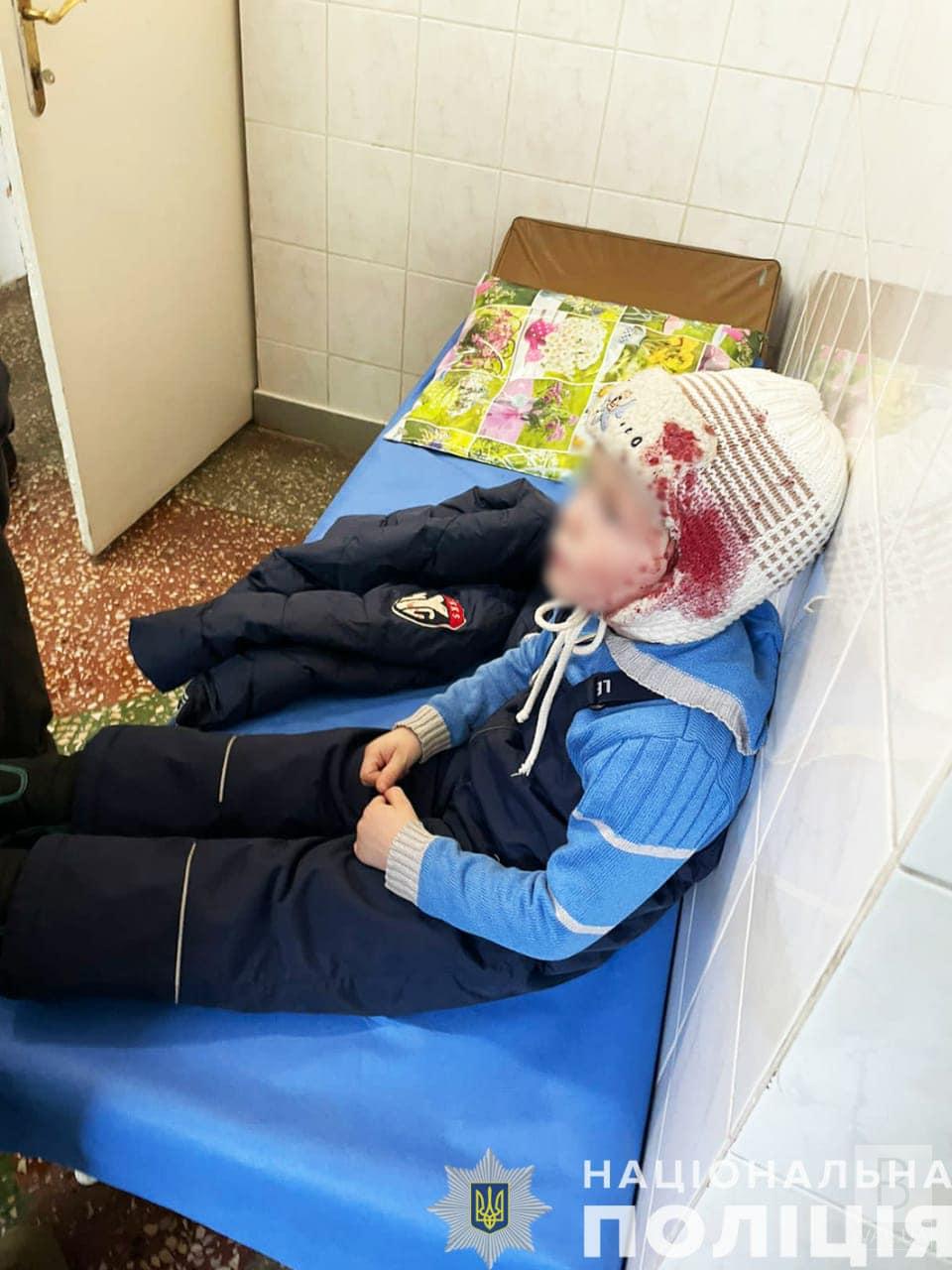 Приїхали провідати родичку: на Чернігівщині внаслідок обстрілу постраждала родина
